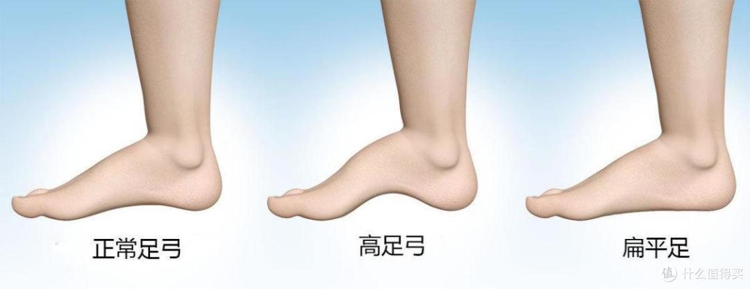 定制矫正鞋科学干预,为运动提供更多可能