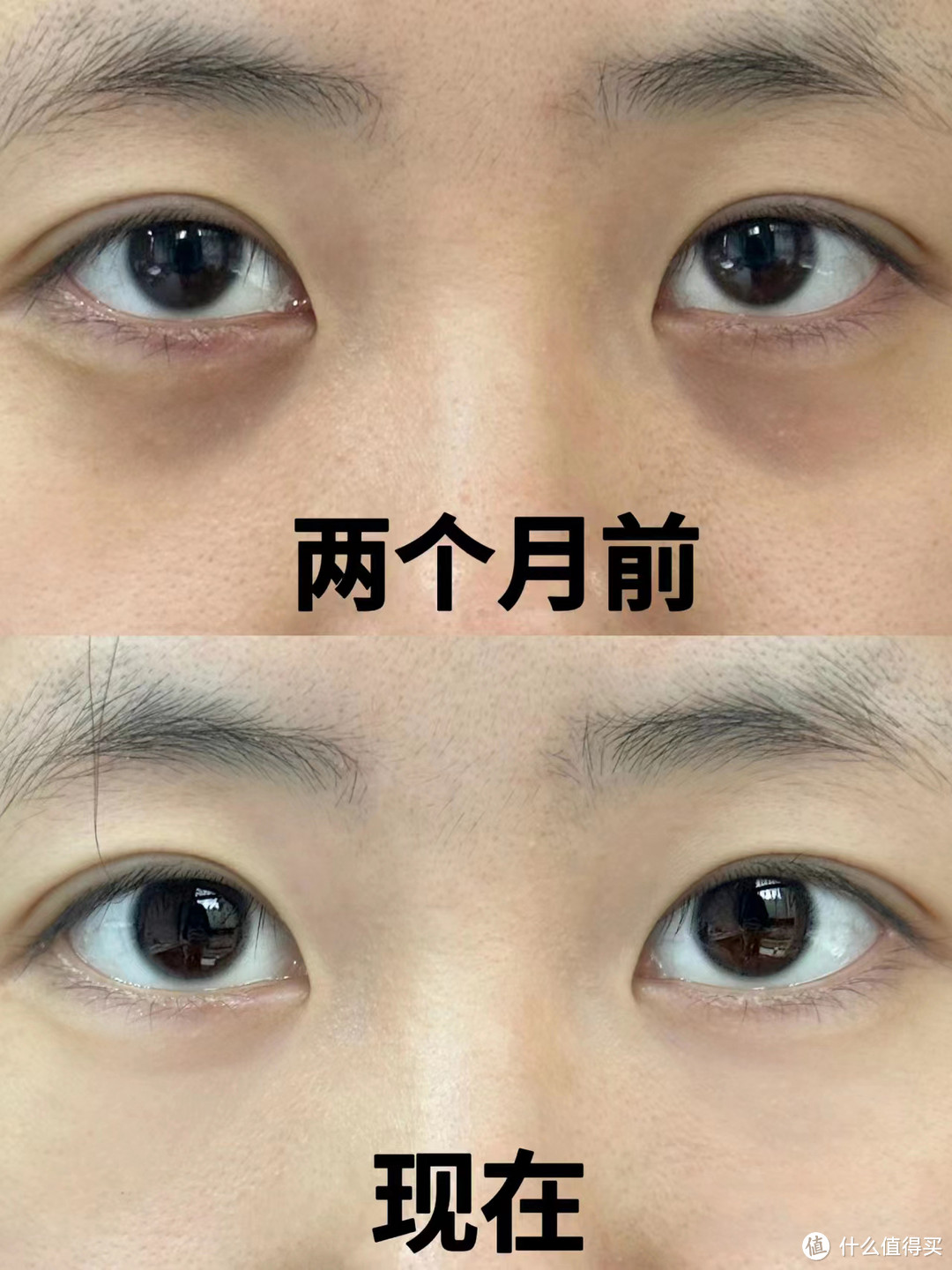 眼袋用眼霜真的能去掉吗？含泪分享，高口碑的热门抗老眼霜