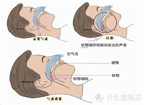 注重睡眠质量丨全自动的双水平乐普BA525M呼吸机才是理想的个人健康睡眠管家