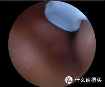 开箱体验西圣可视掏耳勺：耳道清洁新体验！