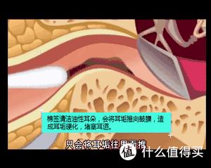 别再用棉签掏耳朵了,清理耳垢就用它,西圣智能可视耳勺