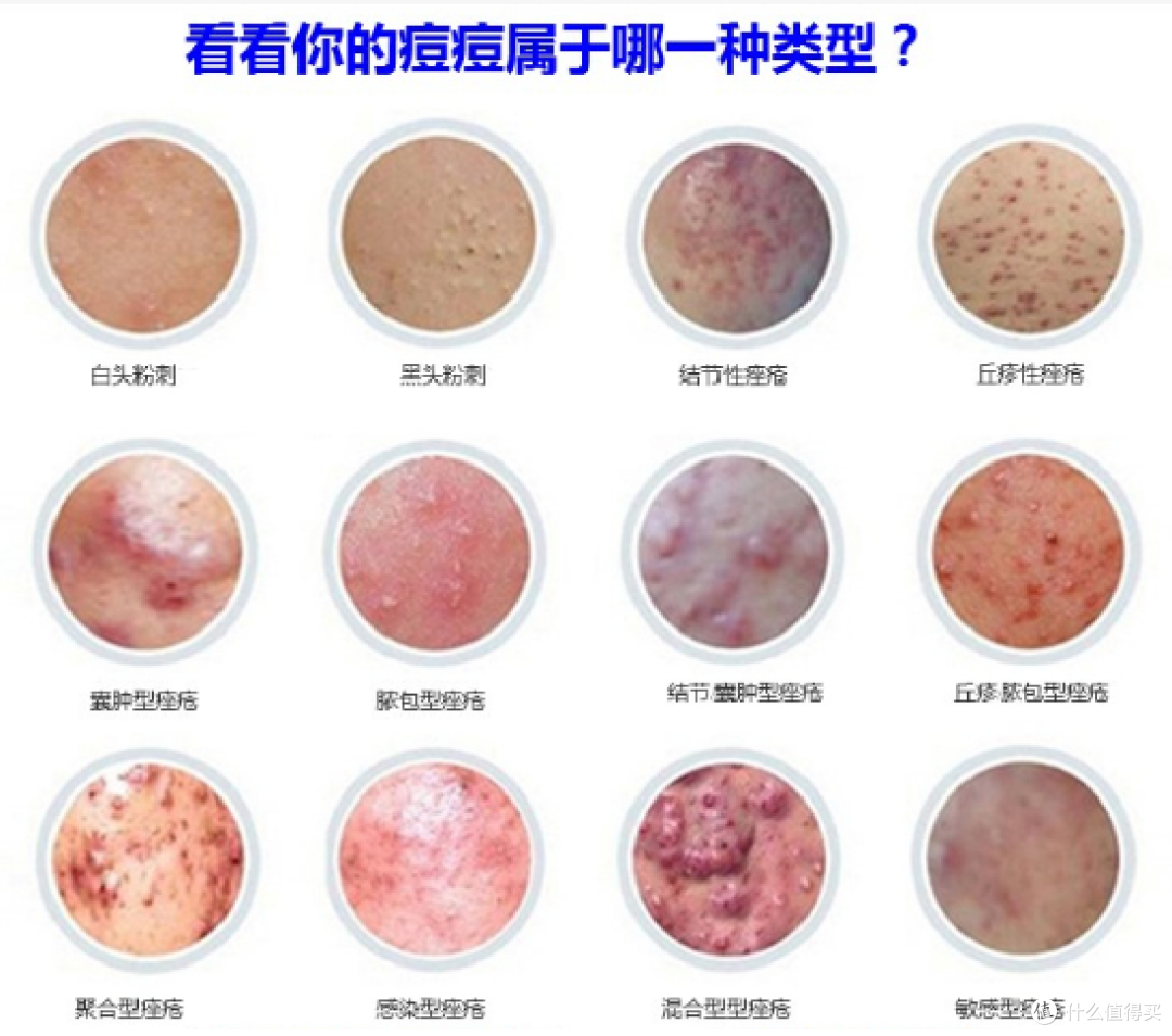 图片来自网络，侵删