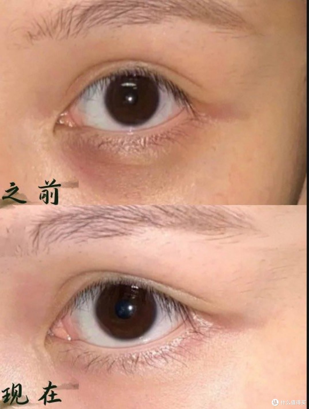 眼霜排名前十名品牌有哪些?必买名单高效解决眼袋、熊猫眼