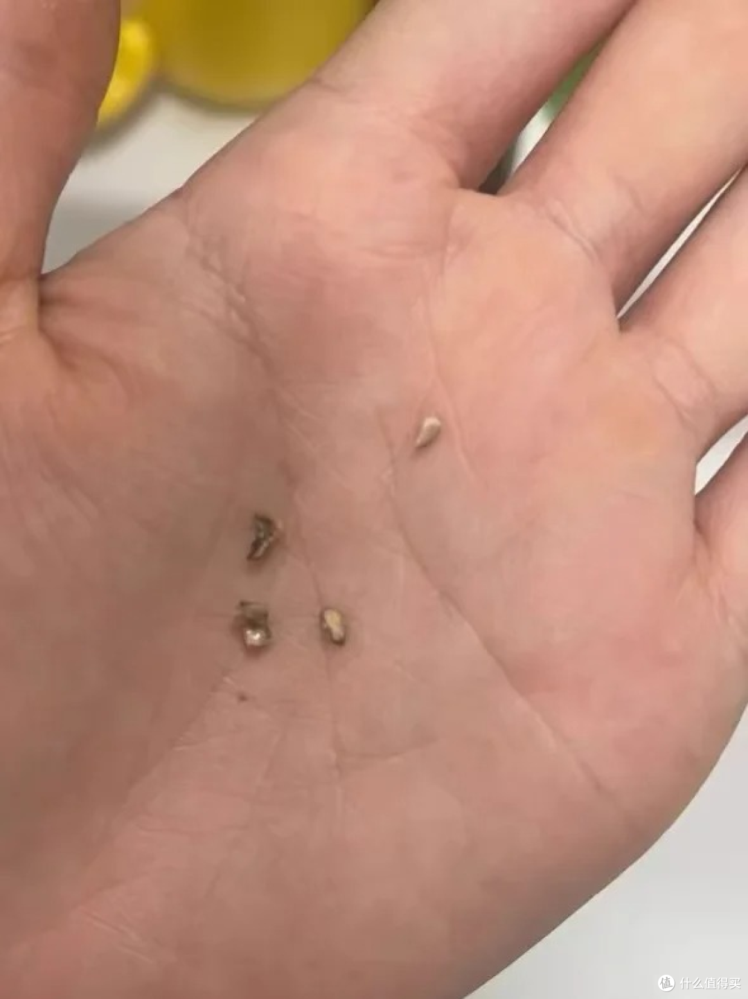 我发誓!真的希望有牙结石的都能刷到!坚决不删!
