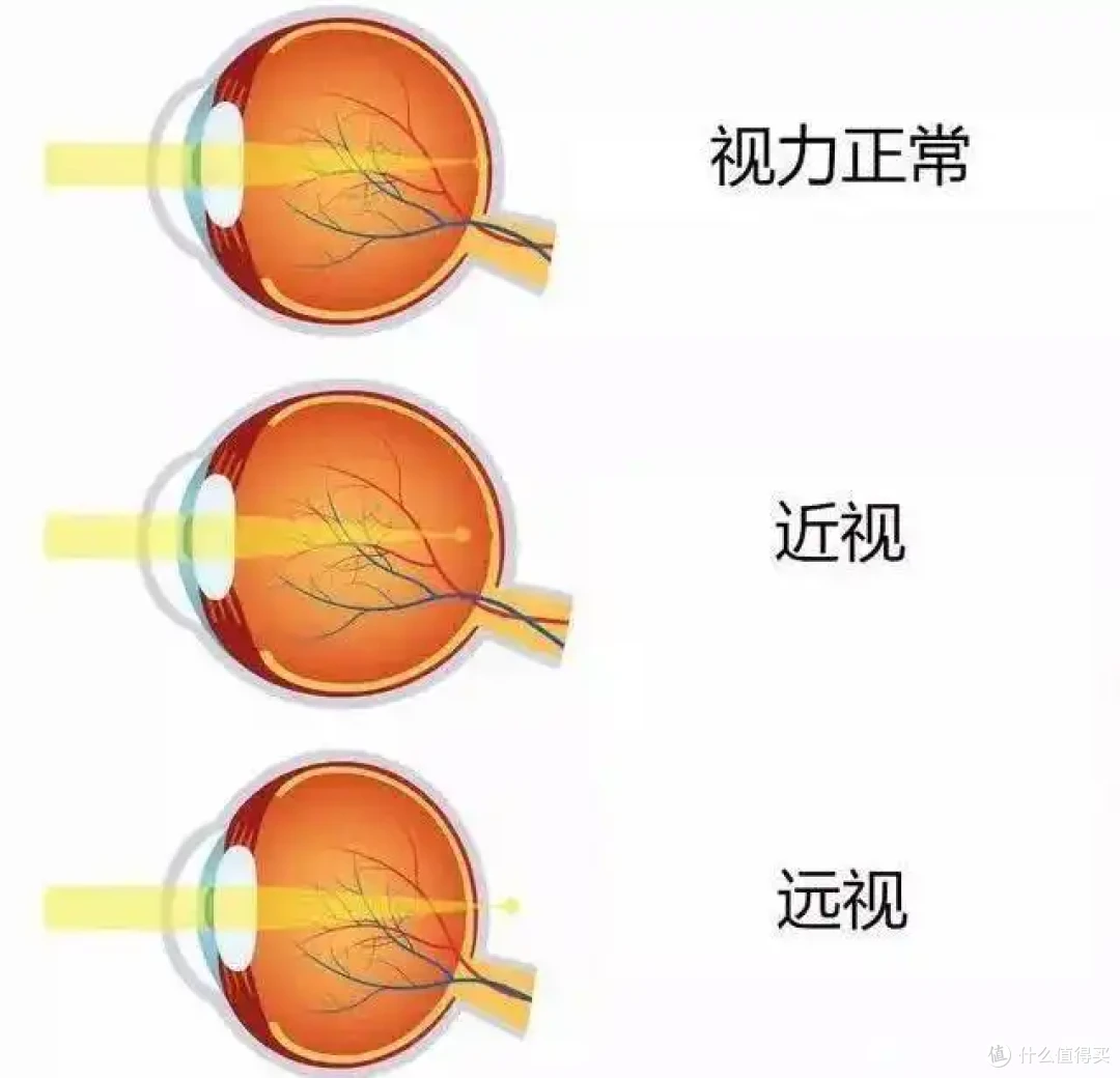 蔡司睐光2.0轻渐进线下配镜成功下车，从此近视老花一镜到底