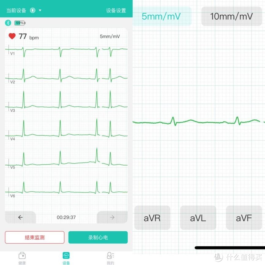 24h私人家庭健康医生：乐普Lepod Pro心电记录仪使用全体验