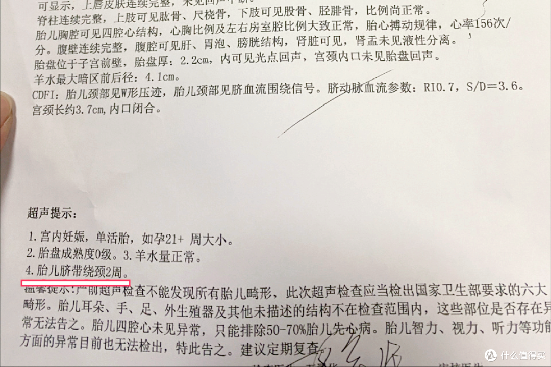 胎儿脐带绕颈6圈遇险情,多亏妈妈机智,孕期这件事千万别偷懒!