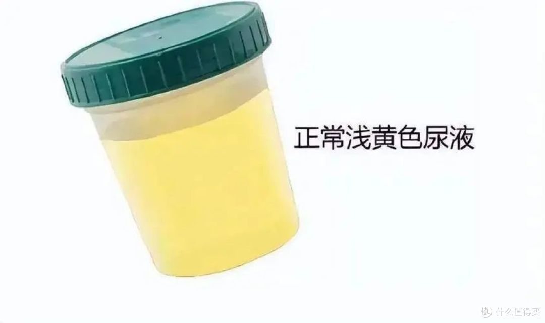 喝水少为啥尿液会变黄?