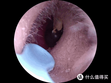西圣Find可视挖耳勺：科技加持，掏耳新体验！