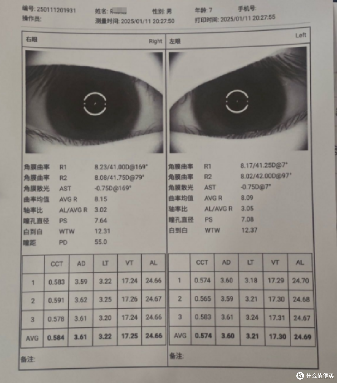 孩子近视了能恢复么?离焦眼镜怎么选?明月镜片轻松控怎么样?