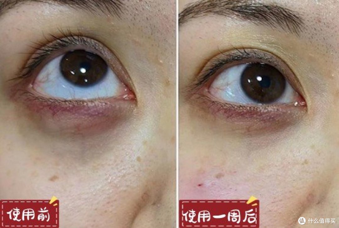 什么眼霜去皱效果好?眼霜排行榜大盘点,30天测评精选!