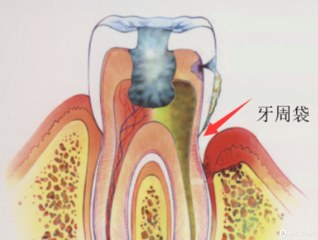 用冲牙器,你牙龈出血吗?拜耳小魔方冲牙器真实使用分享