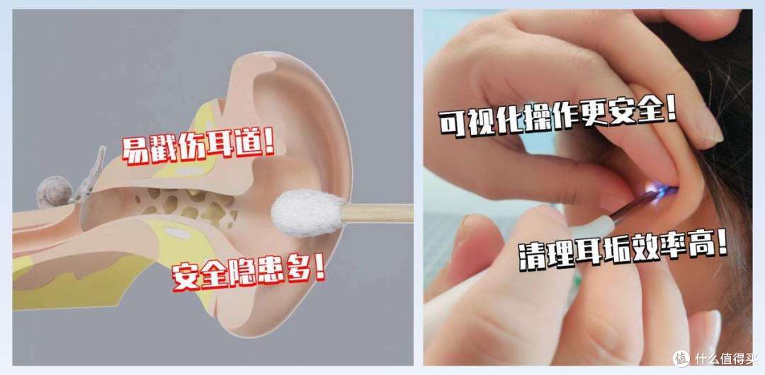 可视挖耳勺是智商税吗?|可视掏耳勺真的有用吗?