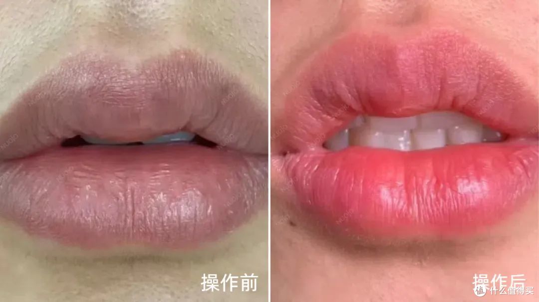 乌唇改妈生唇的掘金潮,美博会反映矫正唇色市场依旧火热