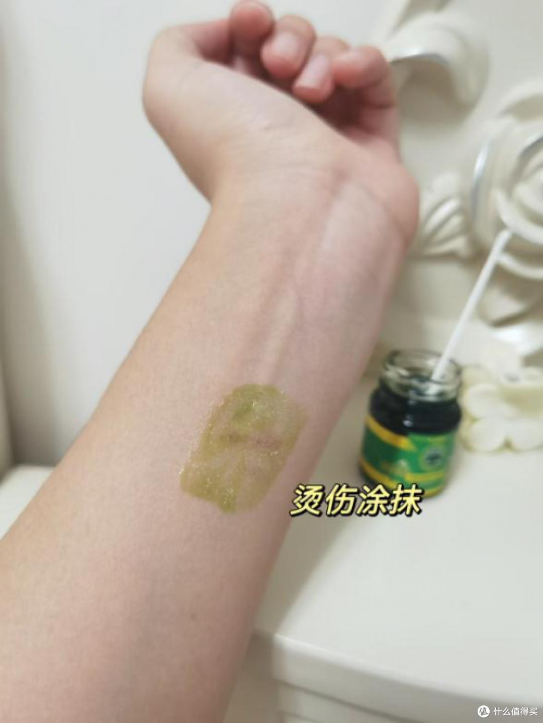 被蚊虫叮咬又肿又痒,该怎么处理?听劝要用泰国卡瓦青草膏