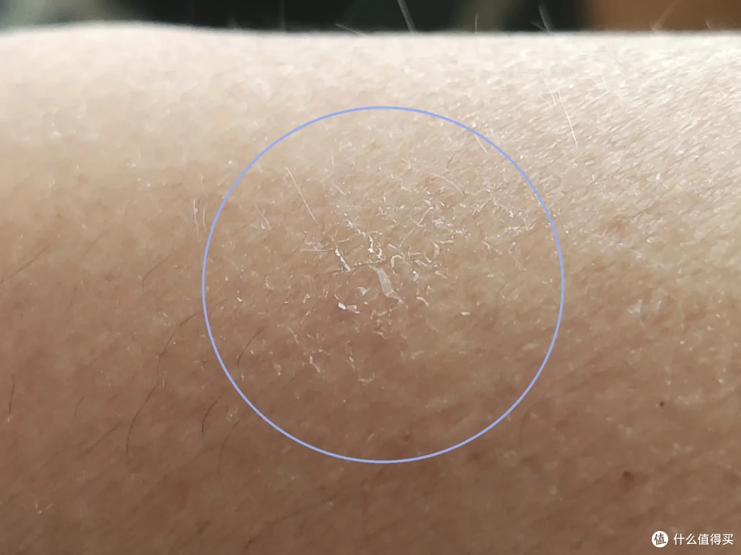 秋冬皮肤痒,十年寻应对之策