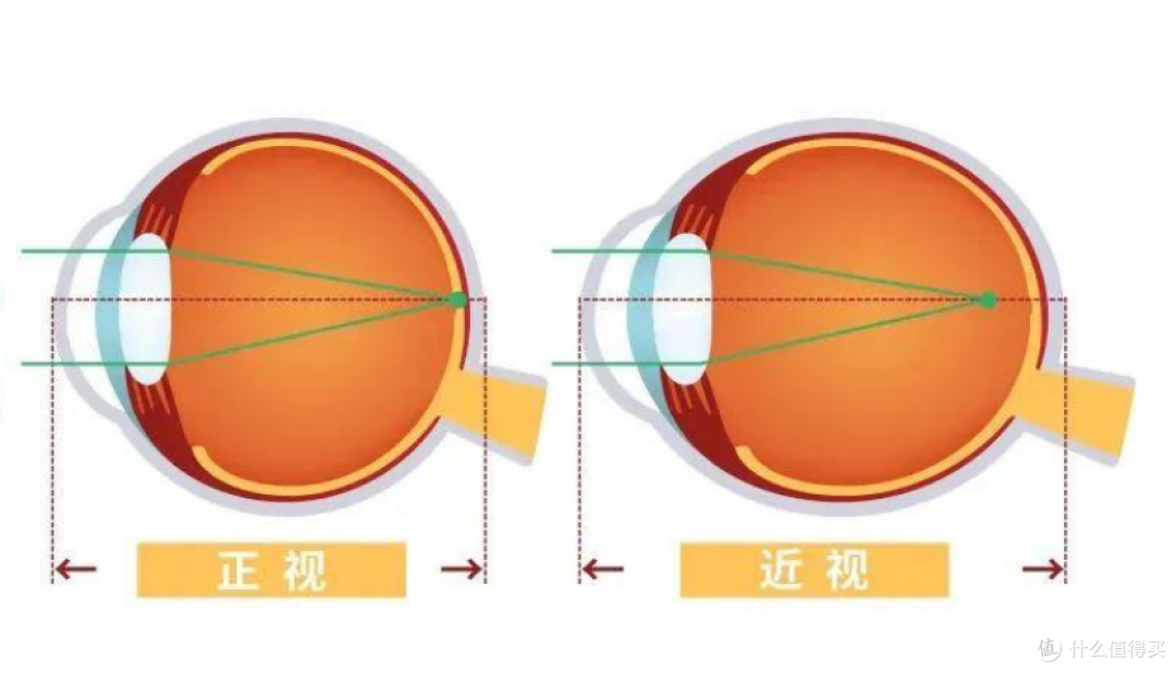 儿童眼睛度数，一年涨多少算正常？如何正确预防近视？
