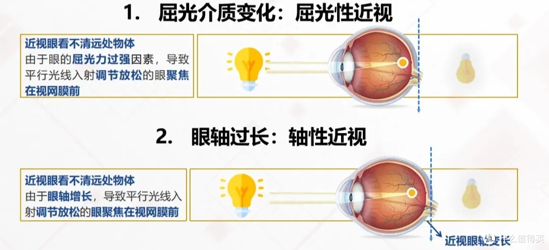 预防近视指南：守护你的明亮双眼