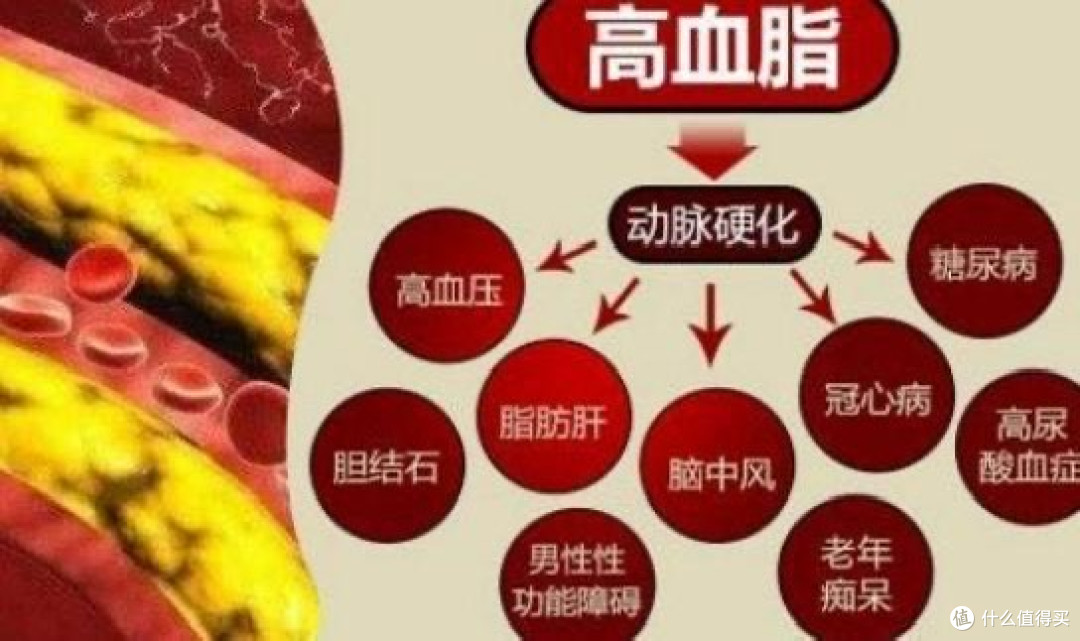 警惕!高血脂正悄然侵蚀你的健康