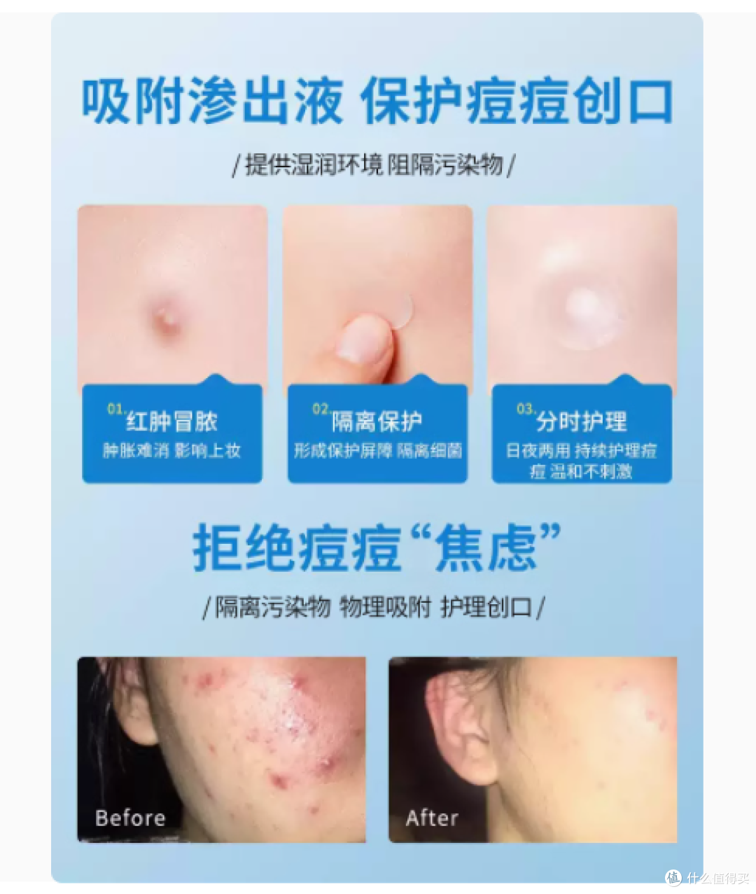 恒品医用痘痘贴,痘痘肌的福音