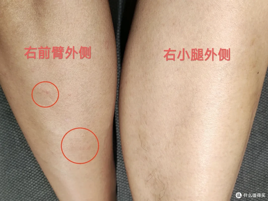 秋冬皮肤痒,十年寻应对之策