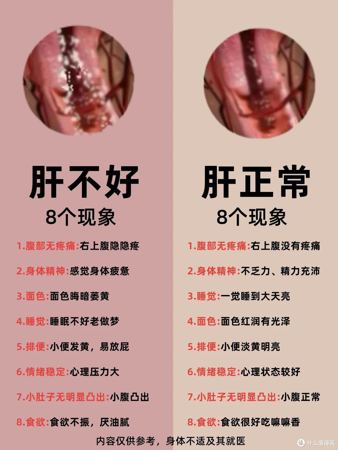 肝不好有这些表现!自测+改善妙招!