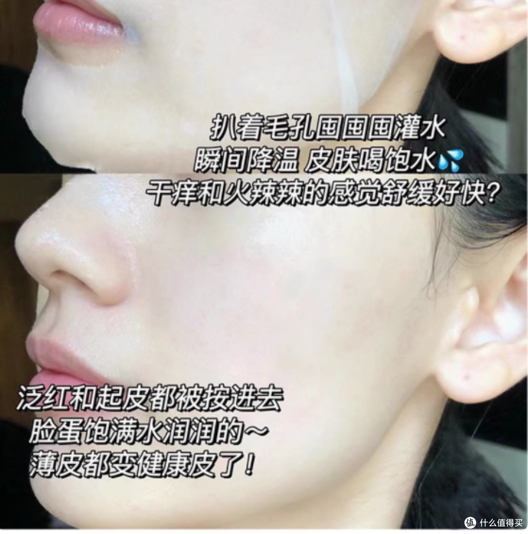 金陵药业医用敷贴:医美术后敏感修护的贴心之选