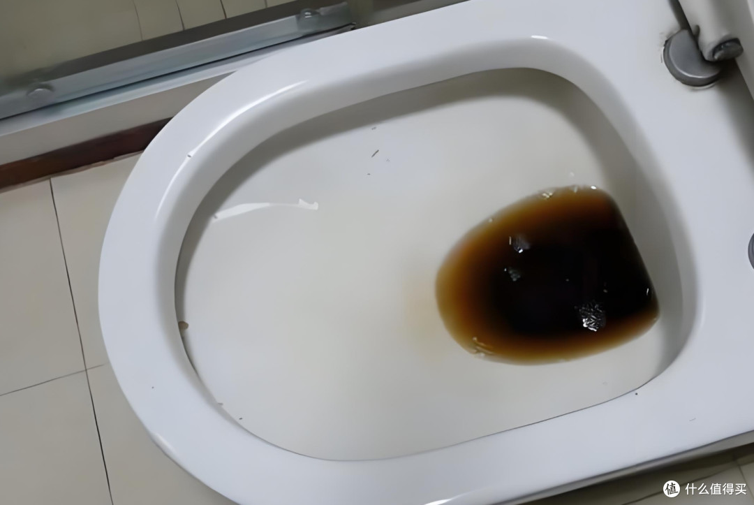 屁股流血别硬扛!肛肠科推荐3种急救方法