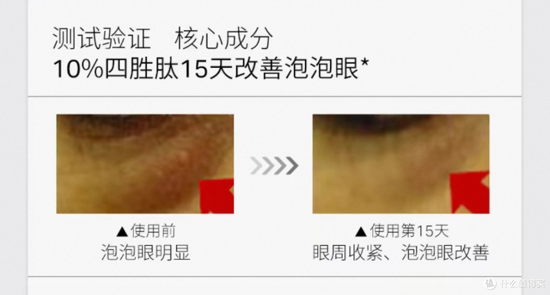优时颜眼部精华液:改善黑眼圈与浮肿