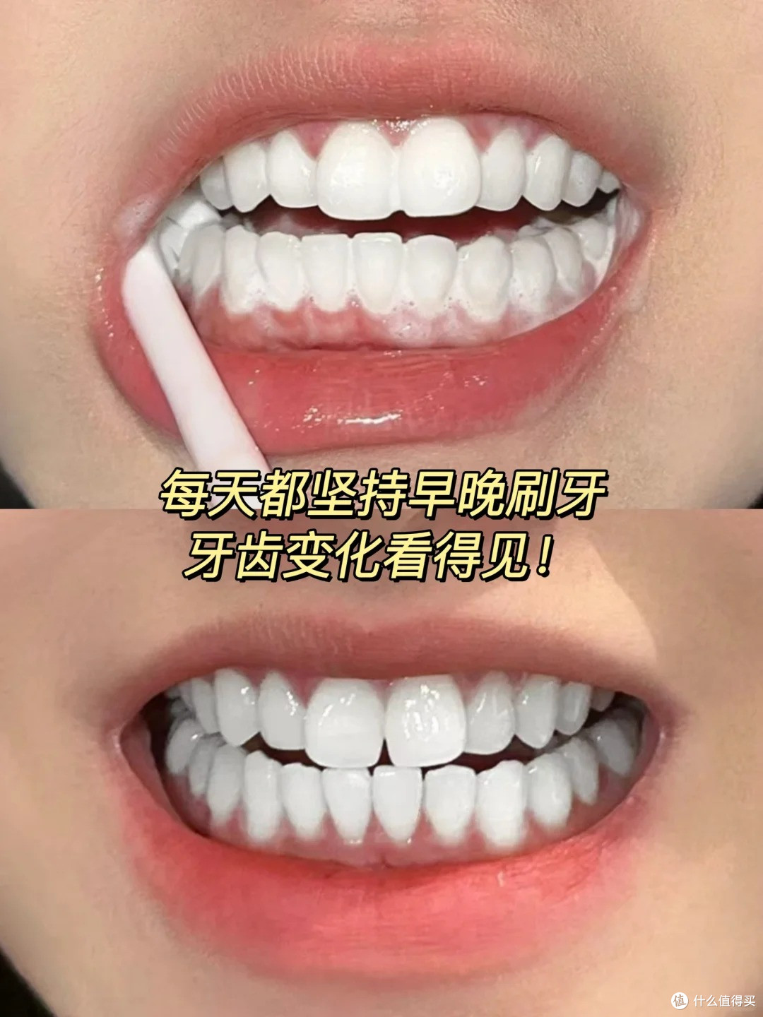 尴尬大黄牙,跟着deepseek的方法,秒变冷白牙