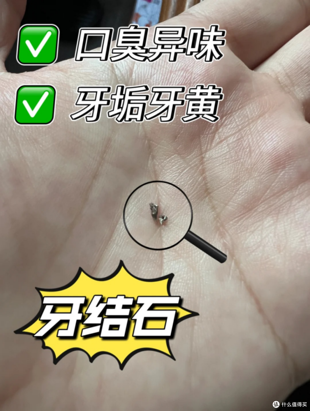 牙结石千万别用手抠了！几十块钱去除牙结石！不再花冤枉钱！