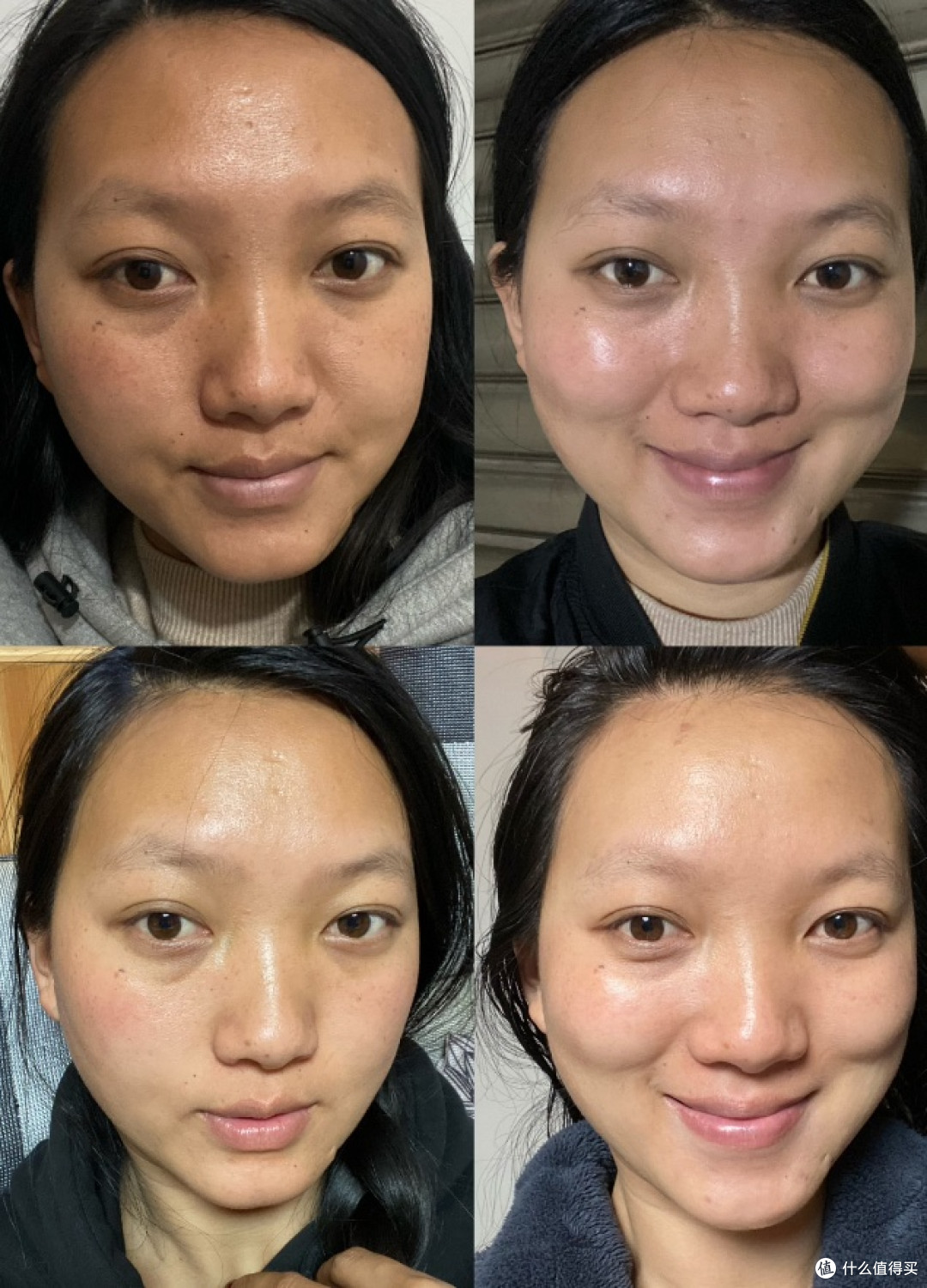 皮肤太黑了,好自卑,有什么方法可以全身都变白吗?(经验分享)
