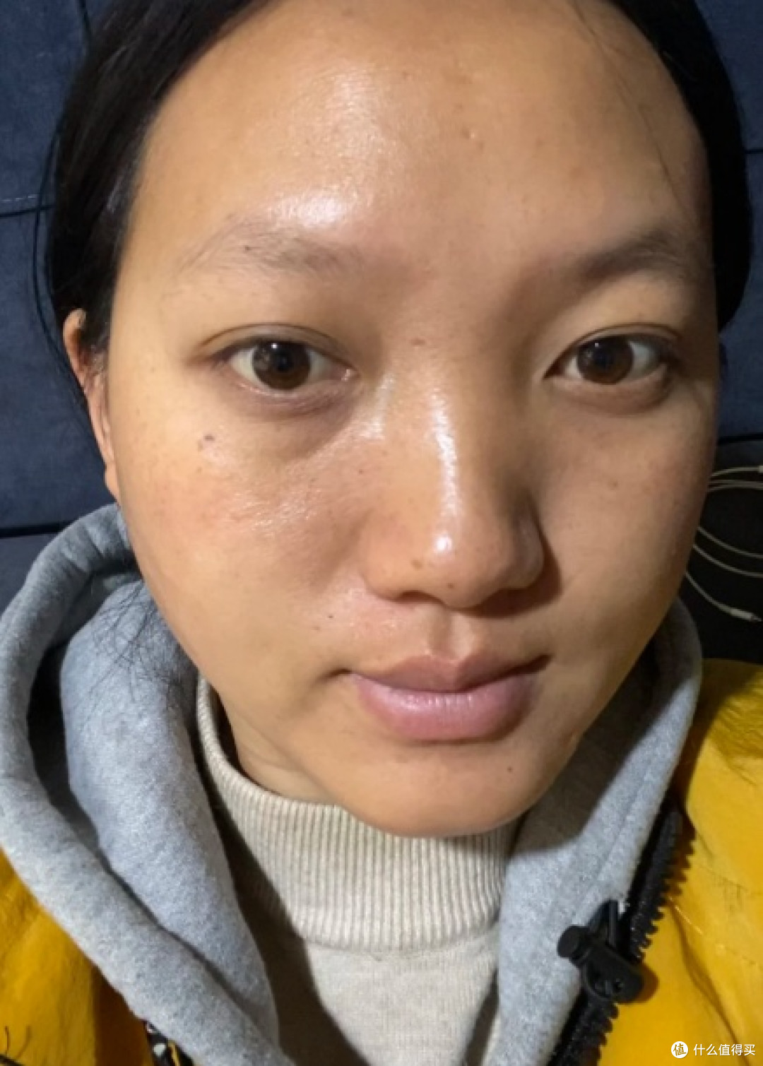 皮肤太黑了,好自卑,有什么方法可以全身都变白吗?(经验分享)