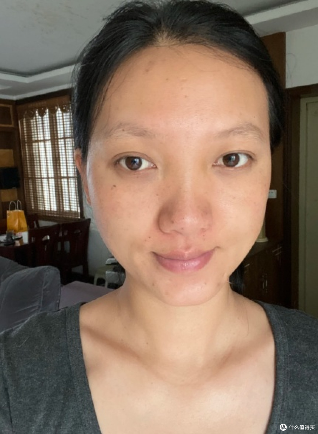 皮肤太黑了,好自卑,有什么方法可以全身都变白吗?(经验分享)