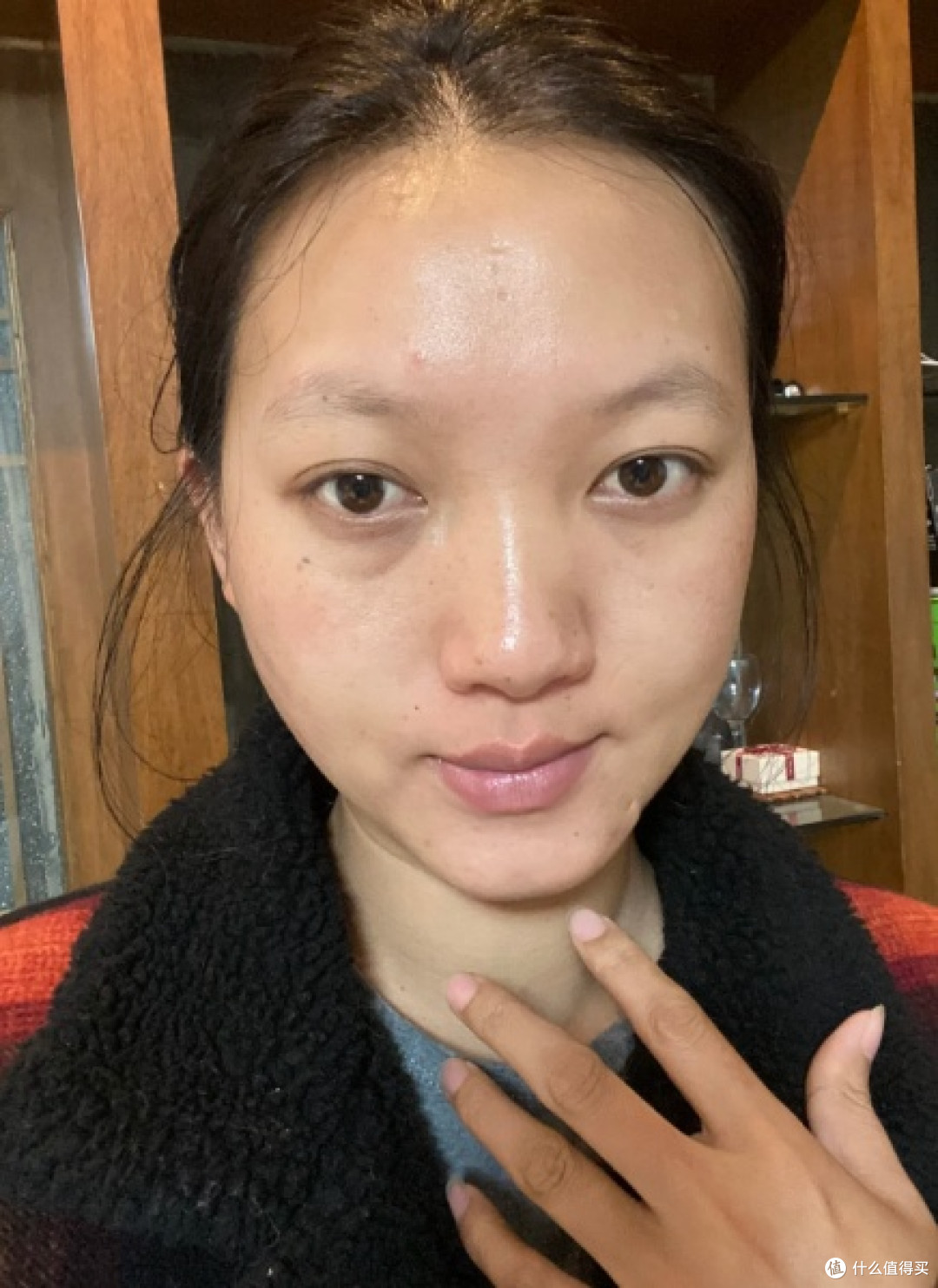 皮肤太黑了,好自卑,有什么方法可以全身都变白吗?(经验分享)