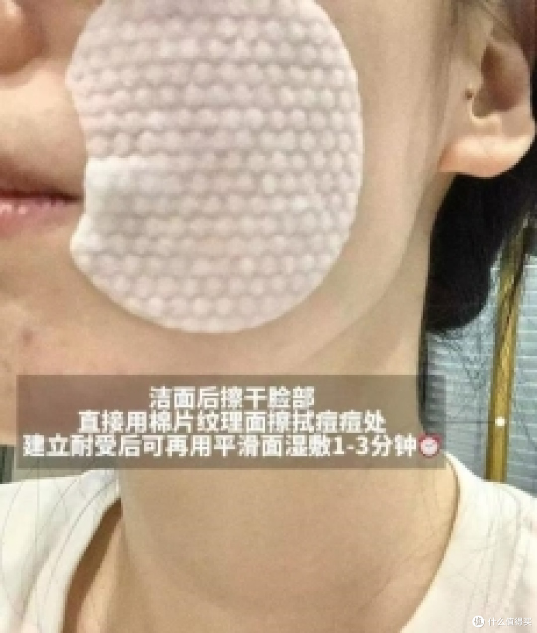 水杨酸棉片:科学祛痘,重塑自我