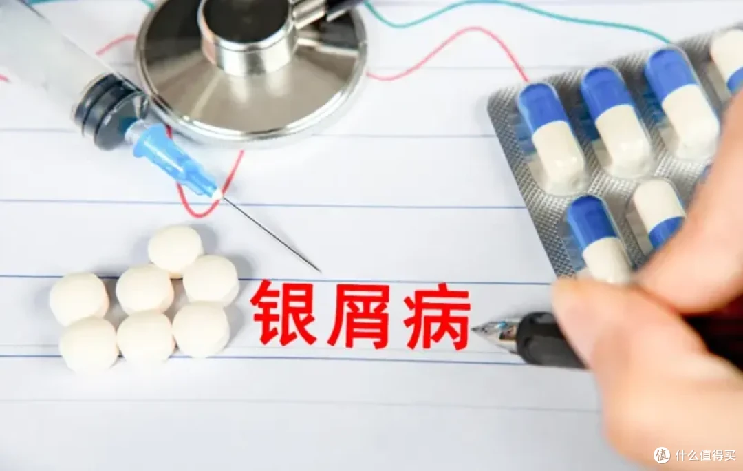 告别银屑病,靶向抗炎才是硬道理,欣比克提供全新选择!