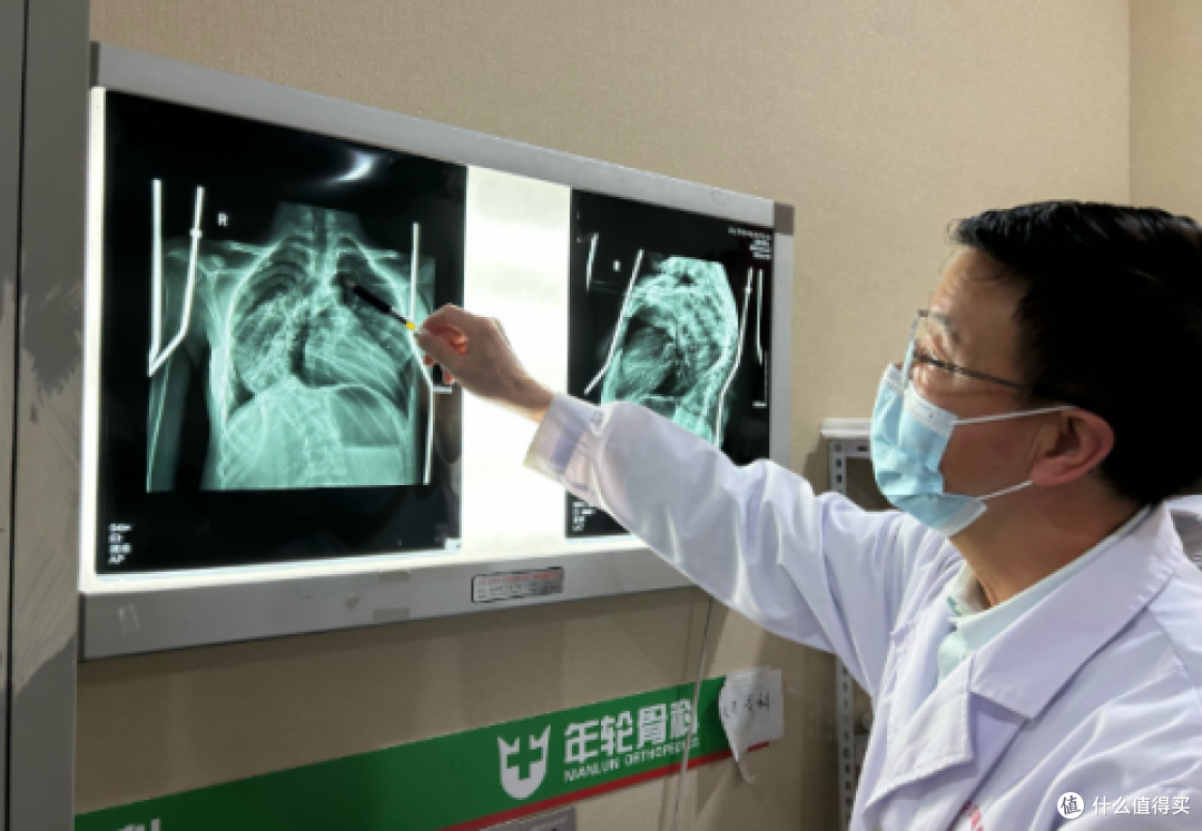 脊柱侧弯：健康隐患不容忽视，北京年轮中医骨科医院助力挺拔身姿