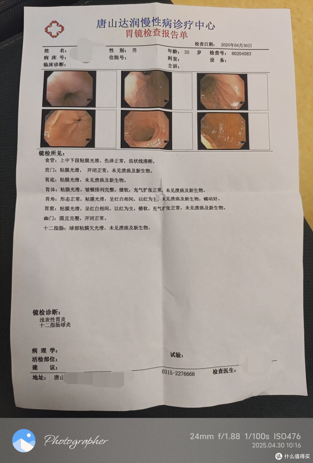 35岁第一次尝试普通胃肠镜