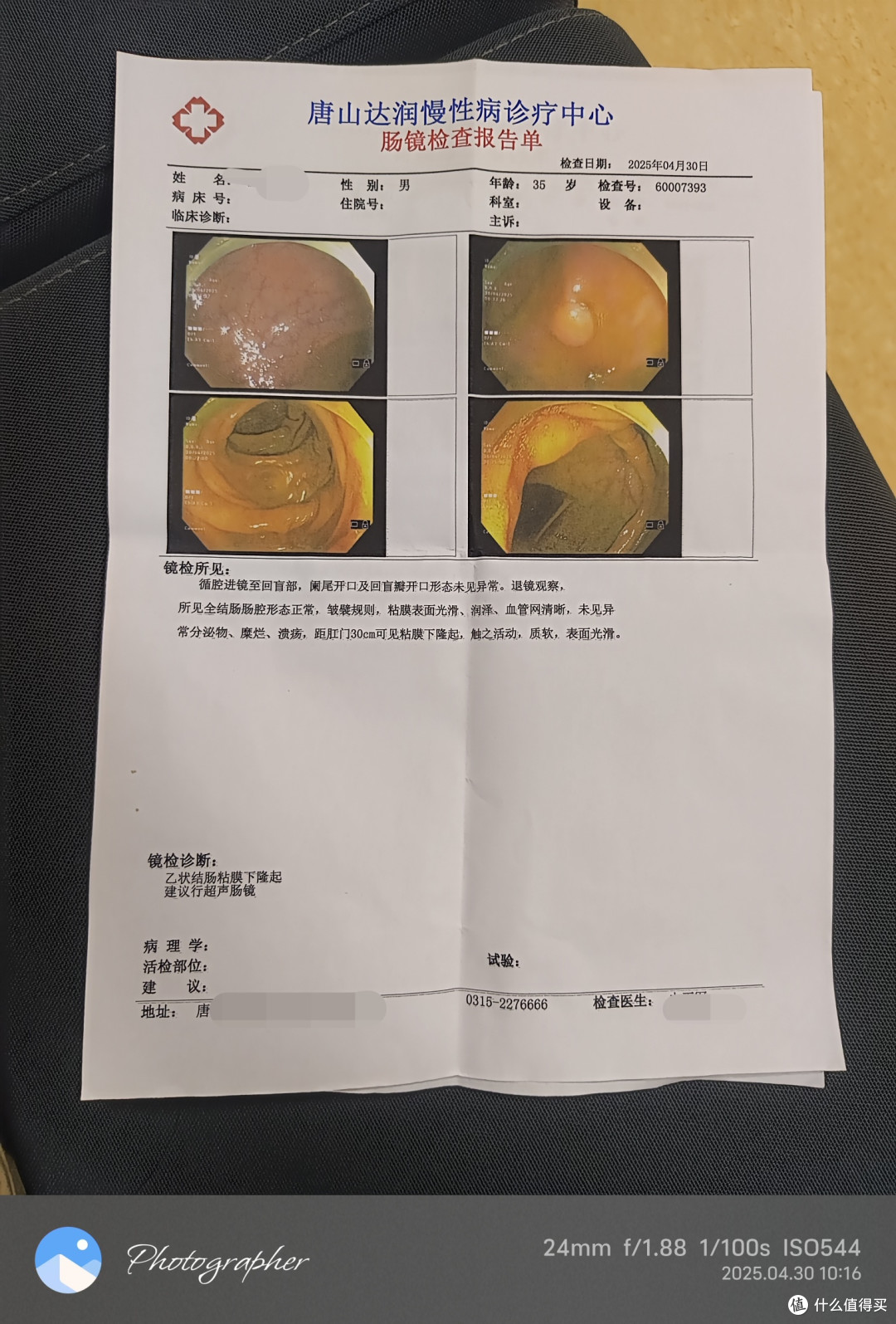 35岁第一次尝试普通胃肠镜