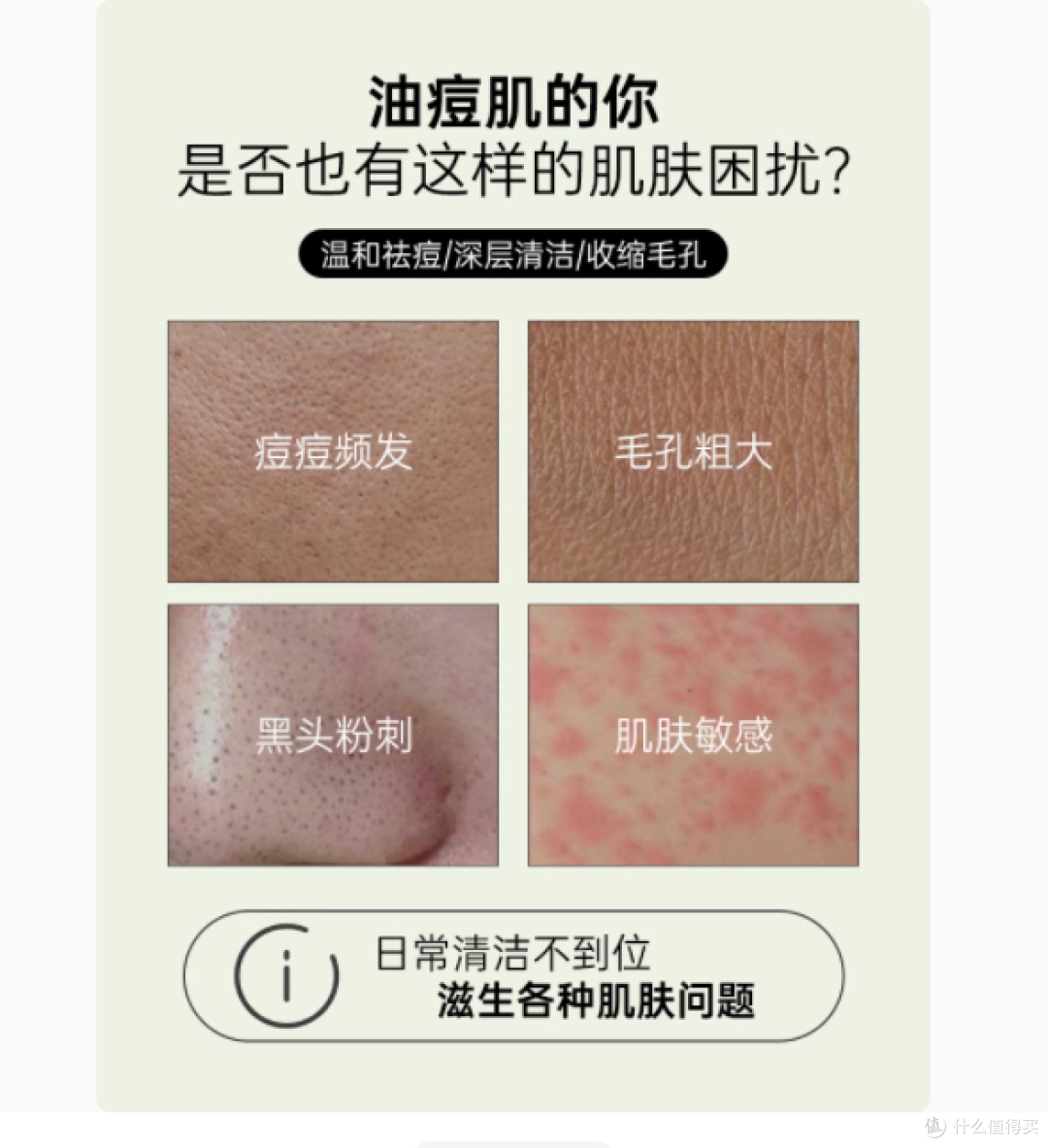 KaufClever 海外旗舰店  Stridex 水杨酸棉片，肌肤问题的救星