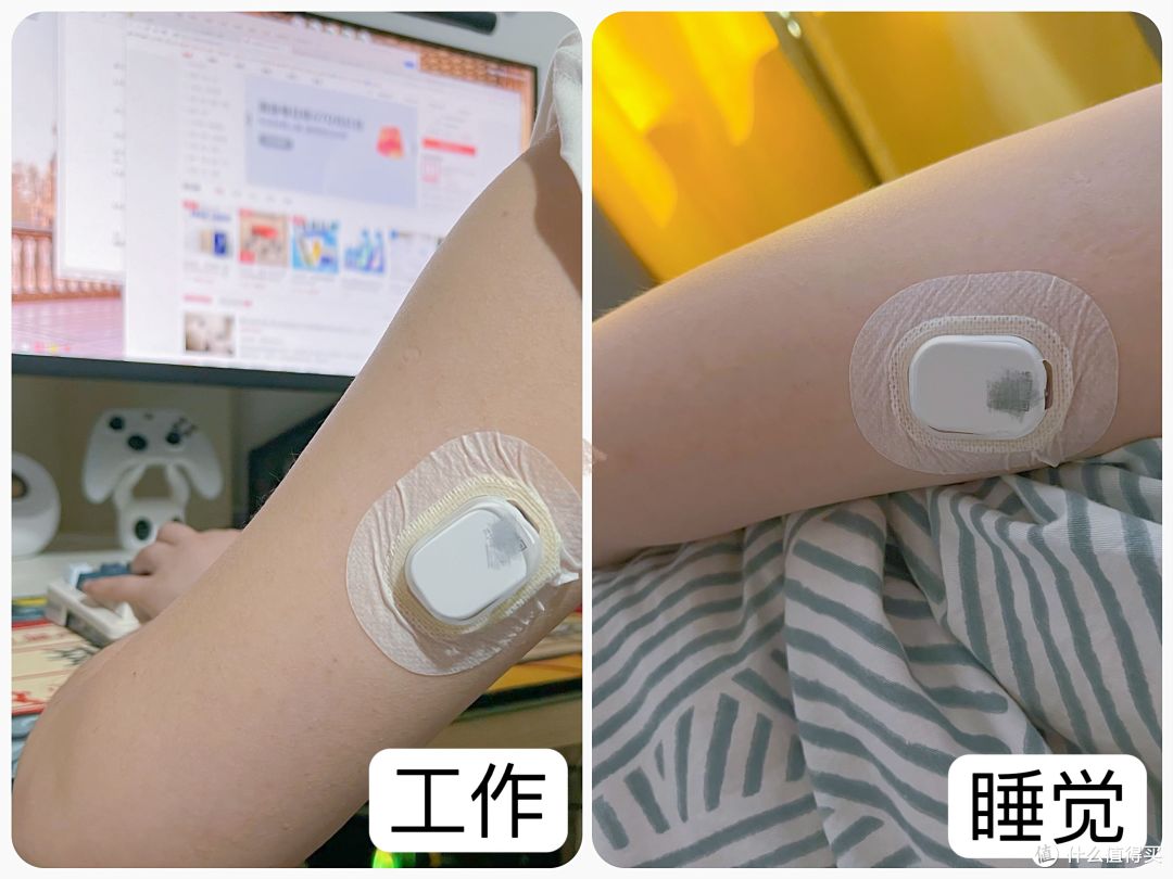 不用扎手指也能测血糖,硅基动感血糖仪,动态控糖才安心