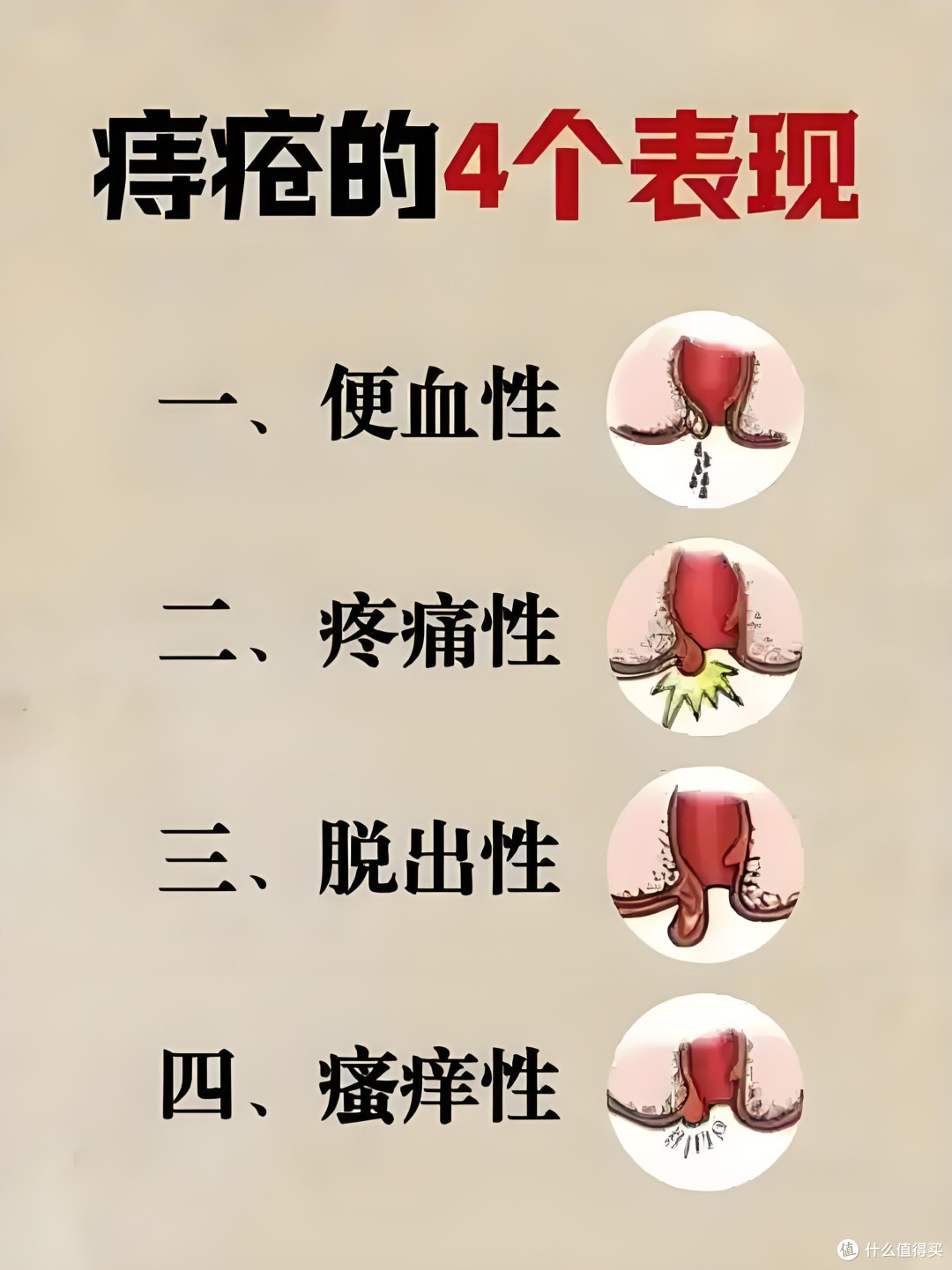 肛门掉出粉色小肉球不痛不痒怎么办教你3个方法自我调理