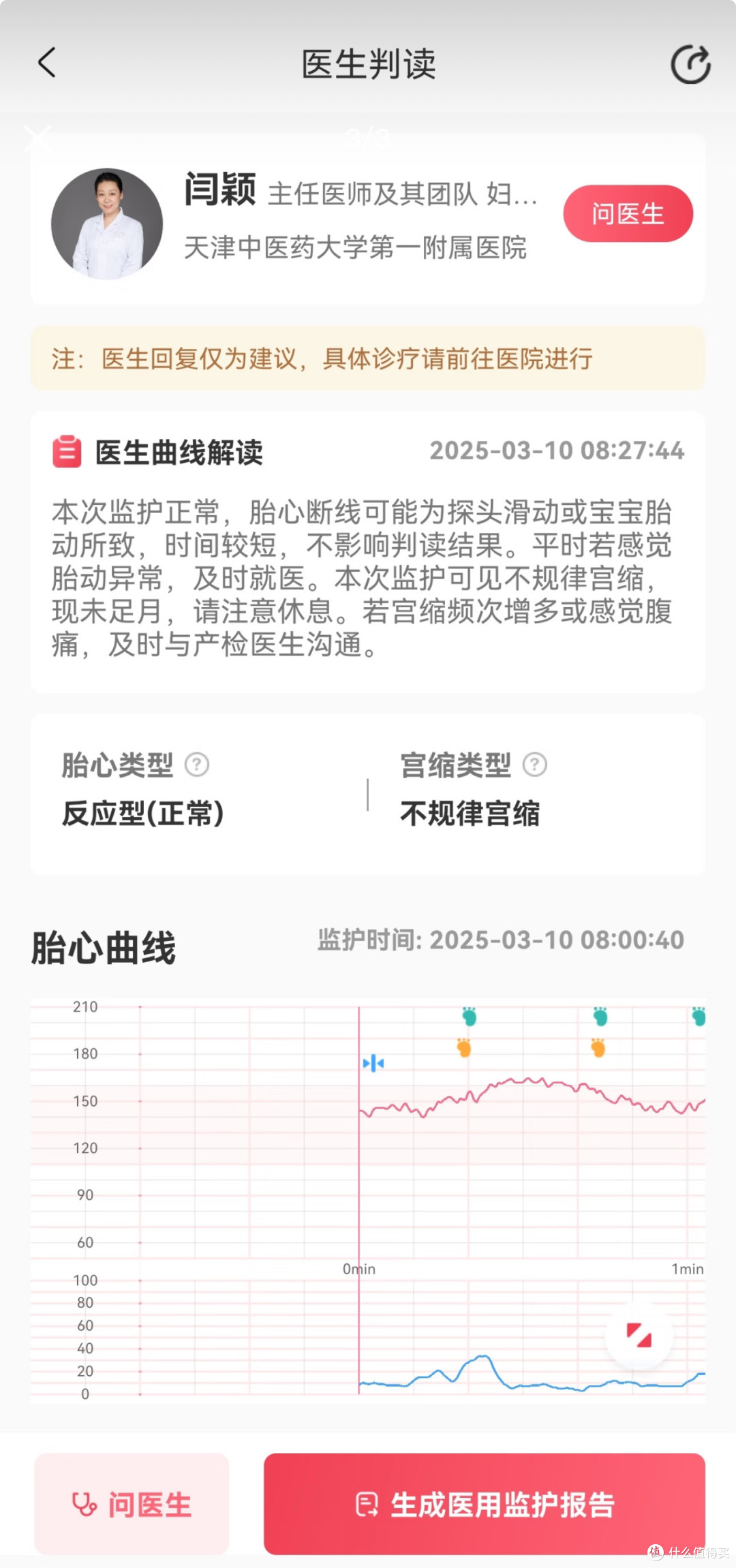 孕晚期胎心监护经验分享