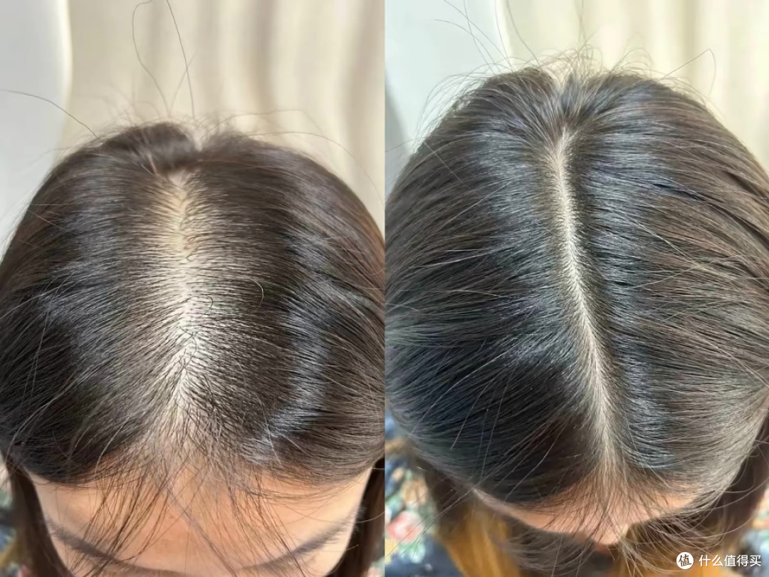 排名第一防脱生发产品，压箱底十大爆火育发品牌，蒲公英变狮子王