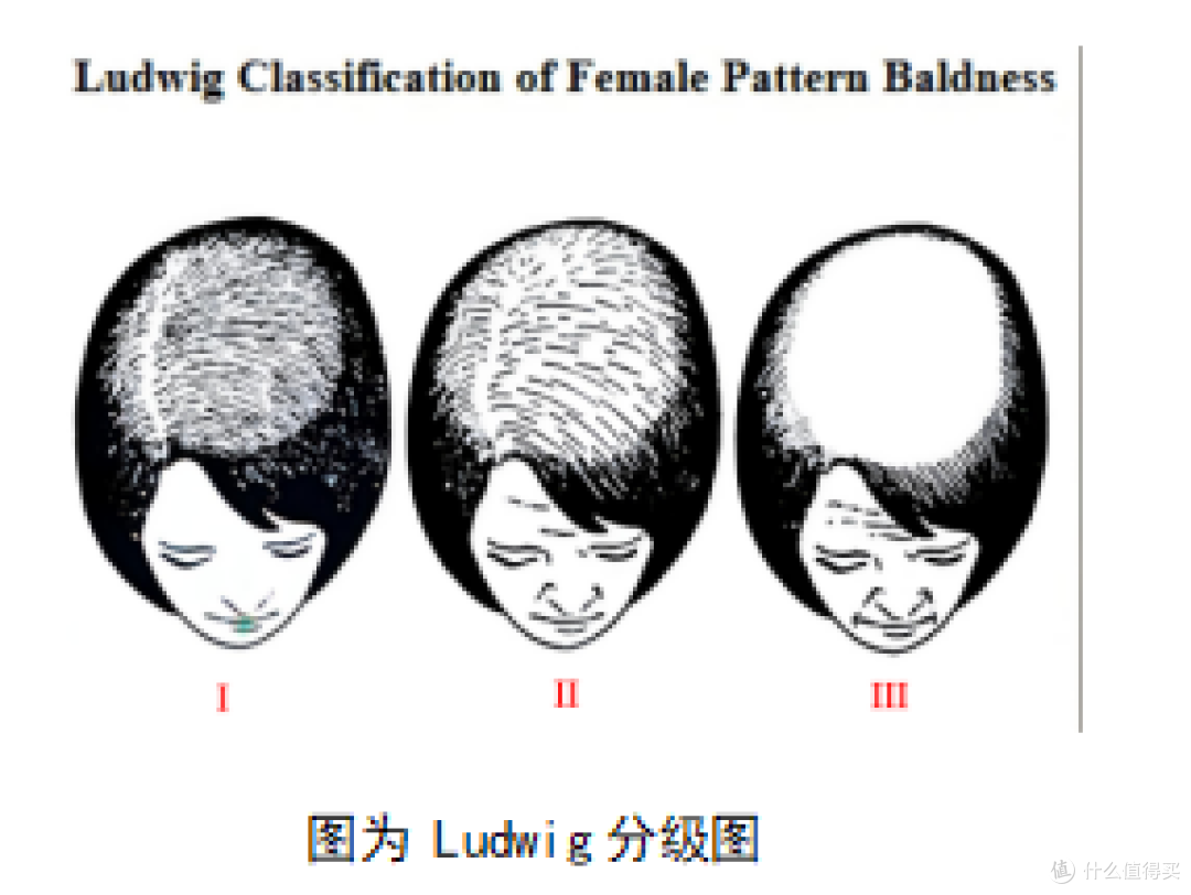   图为 Ludwig分级图