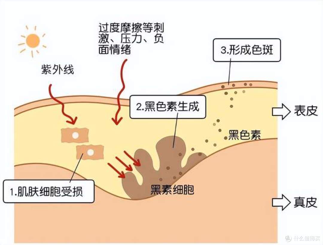 黑色素的形成