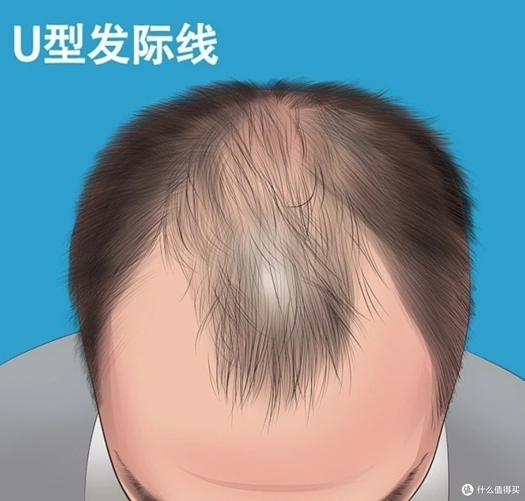 防脱生发产品排名榜，前十款，夏日育发必选项！