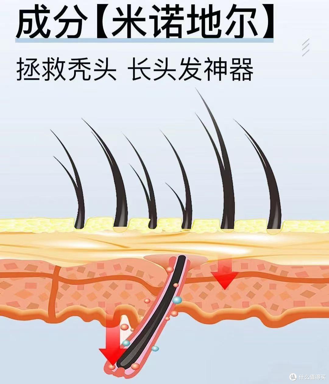 米诺地尔哪个牌子效果好?5%浓度+常温储存成年轻人核心需求