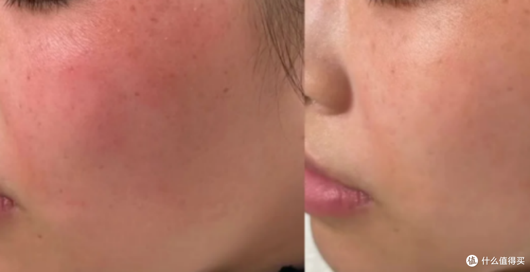 赫徕修复面膜怎么样?种草测评“全能面膜”,看看什么惊喜!
